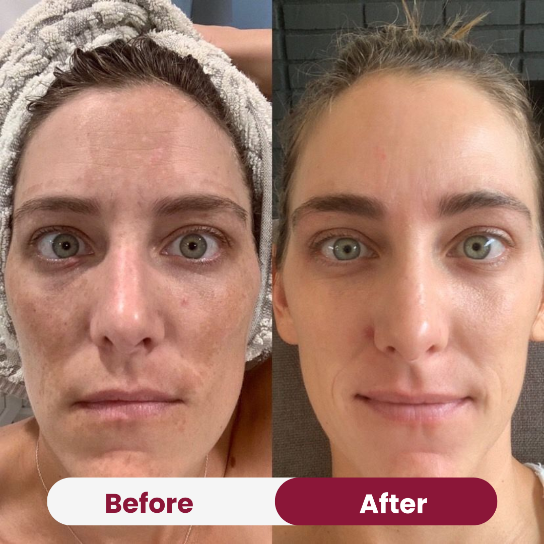 Vitamin C Serum