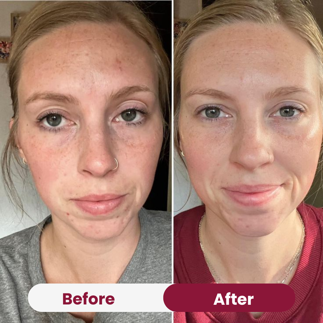 Radiant Niacinamide Sample Sachet