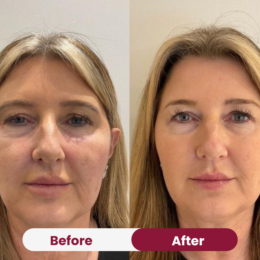 Glow Therapy Duo